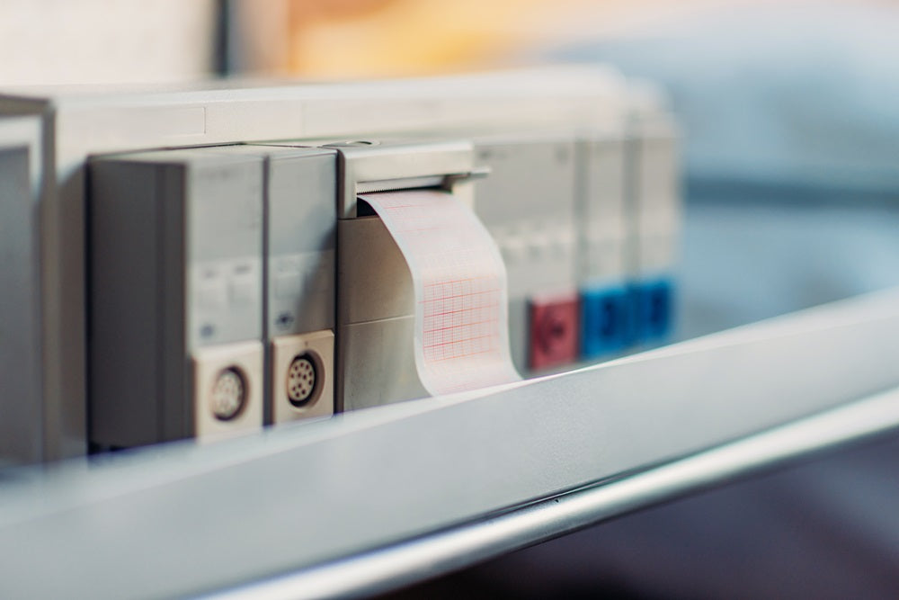 Is It Worth Getting a Thermal Printer?